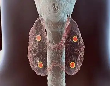 Calcium diseases treatment