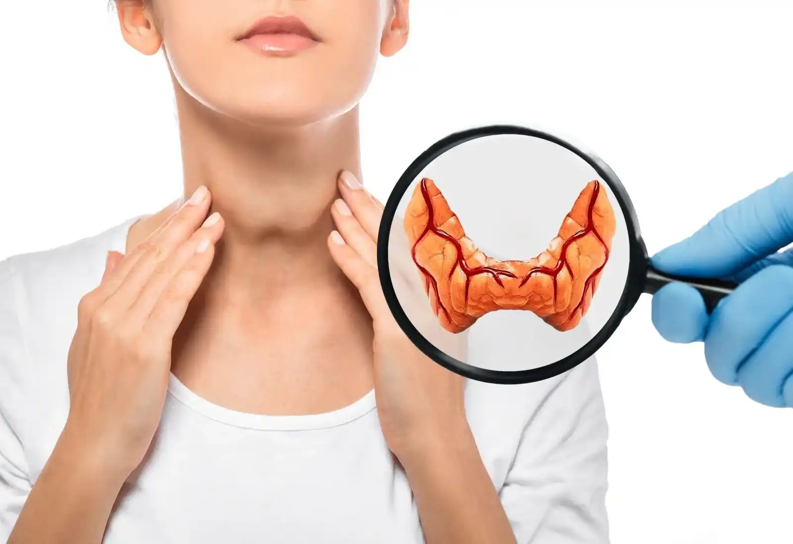hyperthyroidism-treatment