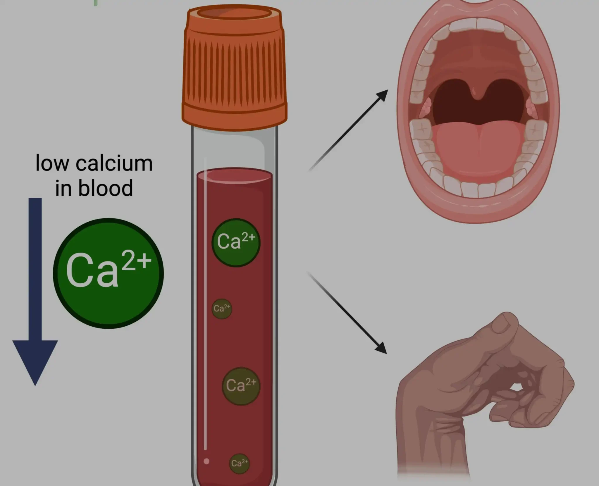 low-calcium-treatment