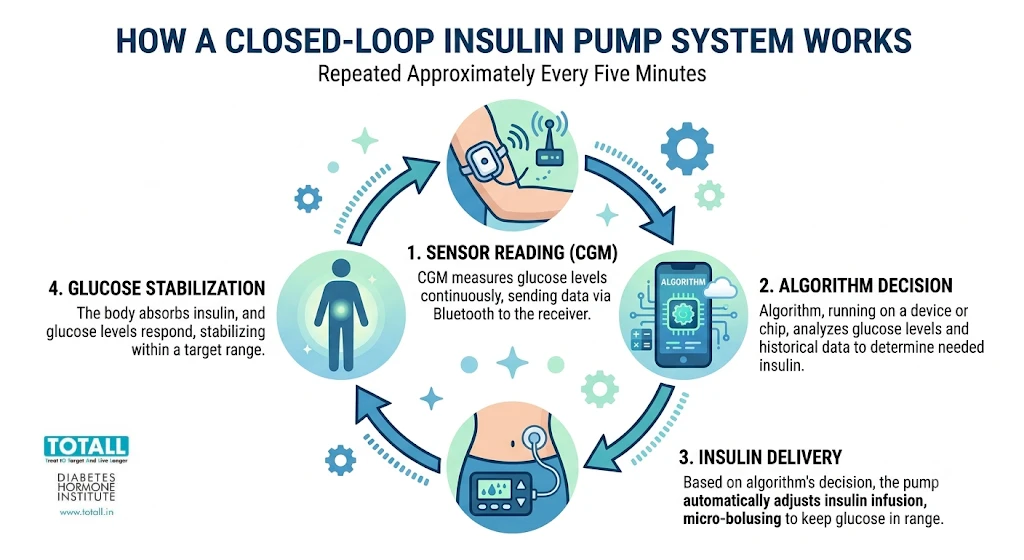 Diagram showing how an AI insulin pump works: CGM sensor, algorithm and insulin pump in a closed loop