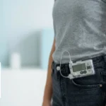 AI insulin pump with CGM sensor worn on the arm, explained by TOTALL Diabetes Hormone Institute Indore