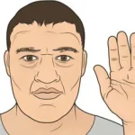 Acromegaly-treatment