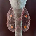 Calcium diseases treatment