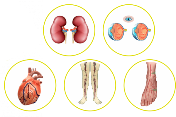 Diabetes body checkup (1)