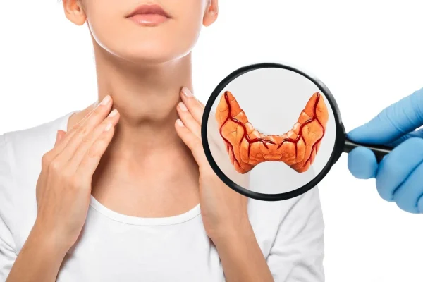 hyperthyroidism (1)