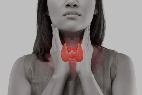 Hypothyroidism (1)
