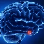 Pituitary gland diseases treatment